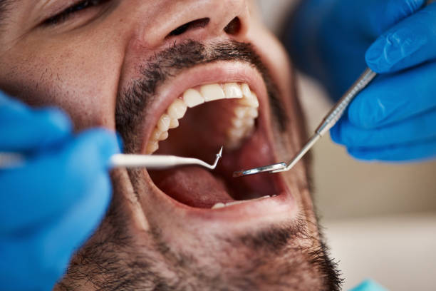 Best Dentist for Severe Toothache  in Higganum, CT